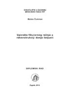 Uporaba fibularnog režnja u rekonstrukciji donje čeljusti