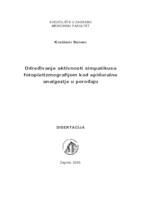 Određivanje aktivnosti simpatikusa fotopletizmografijom kod epiduralne analgezije u porođaju