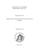 Dijagnostika i liječenje diferenciranih karcinoma štitnjače