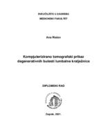 Kompjuterizirano tomografski prikaz degenerativnih bolesti lumbalne kralježnice