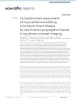 Comprehensive assessment of myocardial remodeling in ischemic heart disease by synchrotron propagation based X-ray phase contrast imaging