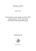 Prokrvljenost žute pjege praćena OCT angiografijom nakon operacije katarakte fakoemulzifikacijom