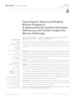 Case Report: Advanced Skeletal Muscle Imaging in S-Adenosylhomocysteine Hydrolase Deficiency and Further Insight Into Muscle Pathology