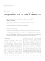 Portomesenteric Reconstruction during Whipple Procedure Using Autologous Left Renal Vein Patch Graft in a Patient with a Gastric Cancer Recurrence