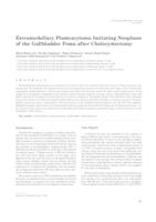 Extramedullary plasmacytoma imitating neoplasm of the gallbladder fossa after cholecystectomy 