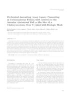 Perforated ascending colon cancer presenting as colocutaneous fistula with abscess to the anterior abdominal wall at the site of a cholecystectomy scar treated with biologic mesh 