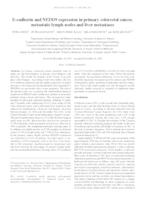 E‑cadherin and NEDD9 expression in primary colorectal cancer, metastatic lymph nodes and liver metastases