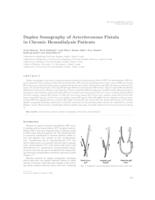 Duplex sonography of arteriovenous fistula in chronic hemodialysis patients