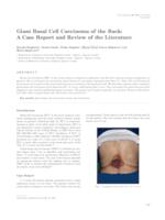 Giant basal cell carcinoma of the back: a case report and review of the literature 