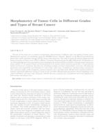 Morphometry of tumor cells in different grades and types of breast cancer 