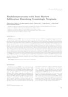 Rhabdomyosarcoma with bone marrow infiltration mimicking hematologic neoplasia 