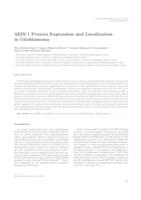 AXIN-1 protein expression and localization in glioblastoma 