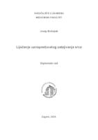 prikaz prve stranice dokumenta Liječenje uznapredovalog zatajivanja srca