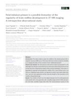 prikaz prve stranice dokumenta Fetal indusium griseum is a possible biomarker of the regularity of brain midline development in 3T MR imaging: A retrospective observational study