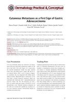 prikaz prve stranice dokumenta Cutaneous Metastases as a First Sign of Gastric Adenocarcinoma