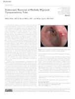 prikaz prve stranice dokumenta Endoscopic Removal of Medially Migrated Tympanostomy Tube