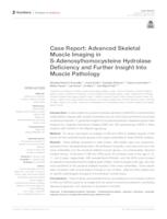 prikaz prve stranice dokumenta Case Report: Advanced Skeletal Muscle Imaging in S-Adenosylhomocysteine Hydrolase Deficiency and Further Insight Into Muscle Pathology