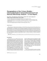 prikaz prve stranice dokumenta Paraganglioma of the urinary bladder - clinicopathological, immunohistochemical and electron microscopy analysis - a case report 