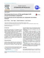 prikaz prve stranice dokumenta Carcinosarcoma de novo of the parotid gland with unusual sarcomatous component