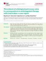 prikaz prve stranice dokumenta Thrombosis of a biological pulmonary valve in a young patient on anticoagulant therapy with rivaroxaban: a case report