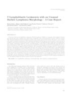 prikaz prve stranice dokumenta T lymphoblastic leukaemia with an unusual Burkitt lymphoma morphology - a case report 