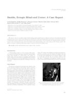 prikaz prve stranice dokumenta Double, ectopic blind-end ureter: a case report 